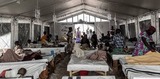 Alerte sur la situation alarmante des épidémies de choléra et de Mpox en RDC